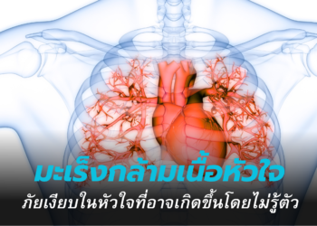 มะเร็งกล้ามเนื้อหัวใจ” ภัยเงียบในหัวใจที่อาจเกิดขึ้นโดยไม่รู้ตัว
