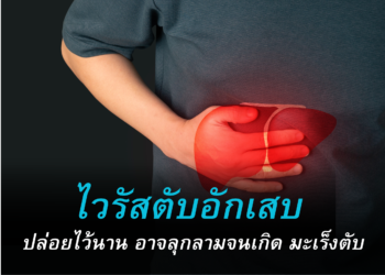 ไวรัสตับอักเสบ ปล่อยไว้นาน อาจลุกลามจนเกิด มะเร็งตับ