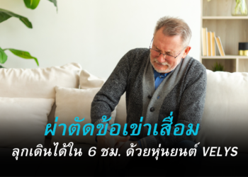 ผ่าตัดข้อเข่าเสื่อม ลุกเดินได้ใน 6 ชม. ด้วยหุ่นยนต์ VELYS