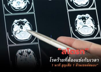 แพทย์เตือน‘สโตรกโรคร้ายที่ต้องแข่งกับเวลา “1 นาที สูญเสีย 1 ล้านเซลล์สมอง”