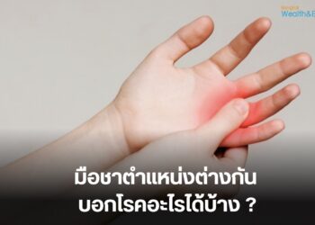 มือชาตำแหน่งต่างกัน บอกโรคอะไรได้บ้าง ?