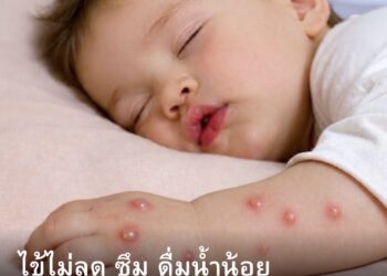 ไข้ไม่ลด ซึม ดื่มน้ำน้อย สัญญาณอันตรายของโรคมือเท้าปาก