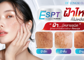 ทำไมฝ้าจึงกลับมาเป็นซ้ำ? DE’ Longse Clinic ไขปัจจัยกระตุ้นฝ้า พร้อมแนวทางดูแลให้เหมาะกับผิว